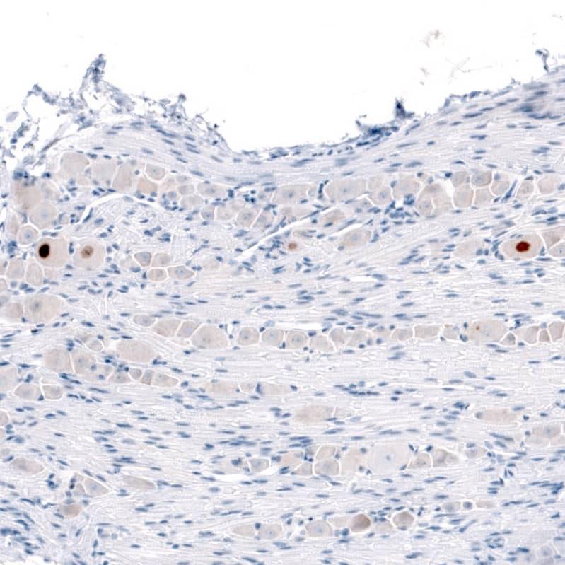 Immunohistochemistry-Paraffin ATF3 Antibody - BSA Free