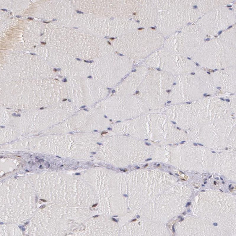 Immunohistochemistry-Paraffin ATF3 Antibody - BSA Free