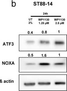 Western Blot: ATF3 Antibody [NBP1-85816] - Usp9X inhibition causes Noxa increase & ER stress in MPNST cell lines. Ultrastructural analysis shows features of paraptosis. (a,b) ST88-14 cells were transfected for 24 h with either non-targeting (NT)-siRNA or Usp9X-siRNA (a) or treated with WP1130 at the concentration of 1.25 & 2.5 µM (b). Whole cell extracts were collected prior to Western blot analysis for ATF3, Noxa &  beta -actin. Numbers shows protein quantification analyzed through ImageJ. N = 3. (c–e) Ultrastructural appearance of untreated control cells using TEM. (f–h) After treatment with WP1130 at the concentration of 2.5 µM (f,g,h) T265-2c cells showed extensive cytosolic vacuolization (f, red arrows) & swelling of ER (g, red arrowheads) & mitochondria (h, red arrows). Image collected & cropped by CiteAb from the following publication (//pubmed.ncbi.nlm.nih.gov/30478285), licensed under a CC-BY license. Not internally tested by Novus Biologicals.