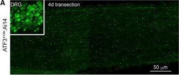 Immunocytochemistry/ Immunofluorescence: ATF3 Antibody [NBP1-85816] - Axotomy does not induce ATF3 in Schwann cells. A, Cryosections from injured DRG (inset) & distal sciatic nerve from the same mouse processed for ATF3 immunohistochemistry (Novus NBP1-85816). B, Punctate staining in the nerve proved to be non-specific fluorescence of leukocytes (note non-nuclear signal in the absence of primary antibody). C, In intact sciatic nerves, cells morphologically identical to Remak cells had at some point undergone recombination. D, Following injury, their numbers increased. E, This was attributable to their proliferation in the injured nerve (as opposed to ATF3 induction & subsequent recombination). C′, D′, Magnification of areas outlined in C & D demonstrate the spindle shaped morphology characteristic of Remak cells. Image collected & cropped by CiteAb from the following publication (//pubmed.ncbi.nlm.nih.gov/30993183), licensed under a CC-BY license. Not internally tested by Novus Biologicals.