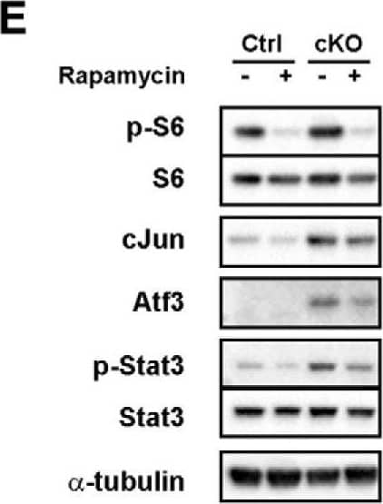 Western Blot: ATF3 Antibody [NBP1-85816] - Nociceptor deletion of Tsc2 preferentially upregulates cJun & Atf3 expression in IB4-positive neurons. A, Immunohistochemistry of L4 DRG contralateral & ipsilateral to a sciatic nerve transection (SN injury) at 3 d post-injury stained for cJun, Isl1 (all neurons), & IB4. Arrows point to cJun-positive, IB4-negative neurons, & arrowheads point to cJun, IB4 double-positive neurons in uninjured Tsc2 cKO DRG. Scale bars: 50 μm. B, Quantification of percentage of cJun-positive neurons from A. C, Immunohistochemistry of L4 DRG for Atf3, Isl1 (all neurons) & IB4. Arrows point to Atf3-positive, IB4-negative neurons & arrowheads point to Atf3, IB4 double-positive neurons in uninjured Tsc2 cKO DRG. Scale bars: 50 μm. D, Quantification of percentage of Atf3-positive neurons from C. E, Western blotting of uninjured control & Tsc2 cKO L4/L5 DRG from mice receiving daily vehicle or rapamycin treatment for 3 d. F, Quantification of protein expression from E. Log2 fold change relative to uninjured control from the same biological replicate. N.S., not significant, *p < 0.05, **p < 0.01, ***p < 0.001, ****p < 0.0001. Extended Data Figure 5-1 shows data values of mean & SEM, number of replicates, statistical tests, & values for all comparisons. Image collected & cropped by CiteAb from the following publication (//pubmed.ncbi.nlm.nih.gov/31182472), licensed under a CC-BY license. Not internally tested by Novus Biologicals.