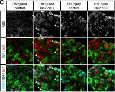 Immunohistochemistry: ATF3 Antibody [NBP1-85816] - Nociceptor deletion of Tsc2 preferentially upregulates cJun & Atf3 expression in IB4-positive neurons. A, Immunohistochemistry of L4 DRG contralateral & ipsilateral to a sciatic nerve transection (SN injury) at 3 d post-injury stained for cJun, Isl1 (all neurons), & IB4. Arrows point to cJun-positive, IB4-negative neurons, & arrowheads point to cJun, IB4 double-positive neurons in uninjured Tsc2 cKO DRG. Scale bars: 50 μm. B, Quantification of percentage of cJun-positive neurons from A. C, Immunohistochemistry of L4 DRG for Atf3, Isl1 (all neurons) & IB4. Arrows point to Atf3-positive, IB4-negative neurons & arrowheads point to Atf3, IB4 double-positive neurons in uninjured Tsc2 cKO DRG. Scale bars: 50 μm. D, Quantification of percentage of Atf3-positive neurons from C. E, Western blotting of uninjured control & Tsc2 cKO L4/L5 DRG from mice receiving daily vehicle or rapamycin treatment for 3 d. F, Quantification of protein expression from E. Log2 fold change relative to uninjured control from the same biological replicate. N.S., not significant, *p < 0.05, **p < 0.01, ***p < 0.001, ****p < 0.0001. Extended Data Figure 5-1 shows data values of mean & SEM, number of replicates, statistical tests, & values for all comparisons. Image collected & cropped by CiteAb from the following publication (//pubmed.ncbi.nlm.nih.gov/31182472), licensed under a CC-BY license. Not internally tested by Novus Biologicals.