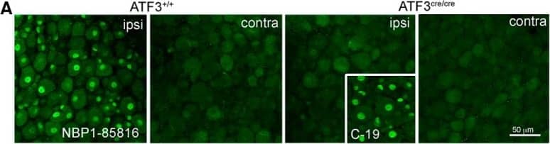 Immunocytochemistry/ Immunofluorescence: ATF3 Antibody [NBP1-85816] - Axotomy-induced recombination in peripherally-projecting neurons. A, Validation of an ATF3-specific antibody. The Novus antibody (NBP1-85816) produces a positive signal in nuclei of axotomized sensory neurons in ATF3+/+ mice, but not ATF3cre/cre mice. Note that the Santa Cruz antibody (C-19) labels neuronal nuclei in in the latter (inset), indicating non-specific staining. B, C, Axotomy induced reporter expression in sensory (DRG), sympathetic (stellate ganglion, SG), & motoneurons 4 d after injury. D, Reporter expression in sensory axons & motoneurons one week after injury. E, Preventing CreERT2 translocation from cytoplasm to nucleus with ICI 182780 reduces recombination in ATF3+ cells (by ∼50%). F, Recombination efficiency 16 d after injury was calculated by expressing the proportion of tracer-filled somata (labeled at the time of injury) that were also reporter (tdtomato)-positive. G, Recombination efficiencies at 4 & 16 d after injury (n = 3 for each time point) for DRG & motoneurons. Images in panels A, B, E were taken from whole mounts, those in C, D, F from cryosections. Image collected & cropped by CiteAb from the following publication (//pubmed.ncbi.nlm.nih.gov/30993183), licensed under a CC-BY license. Not internally tested by Novus Biologicals.