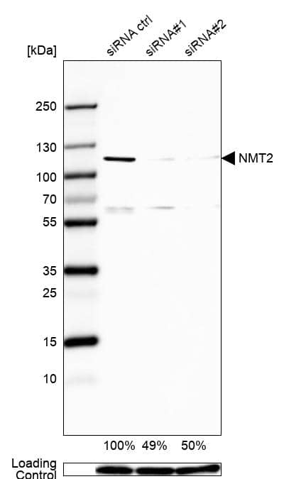 <b>Genetic Strategies Validation. </b>Analysis in U2OS cells transfected with control siRNA, target specific siRNA probe #1 and #2, using Anti-NMT2 antibody. Remaining relative intensity is presented. Loading control: Anti-GAPDH.