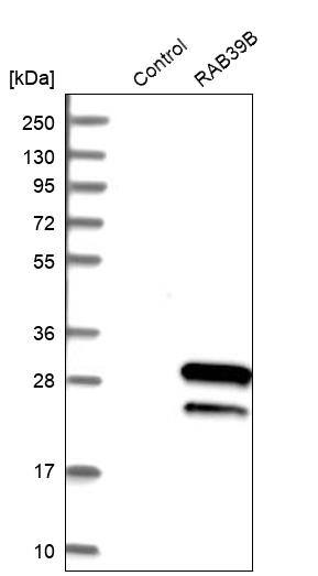 Western Blot RAB39B Antibody - BSA Free