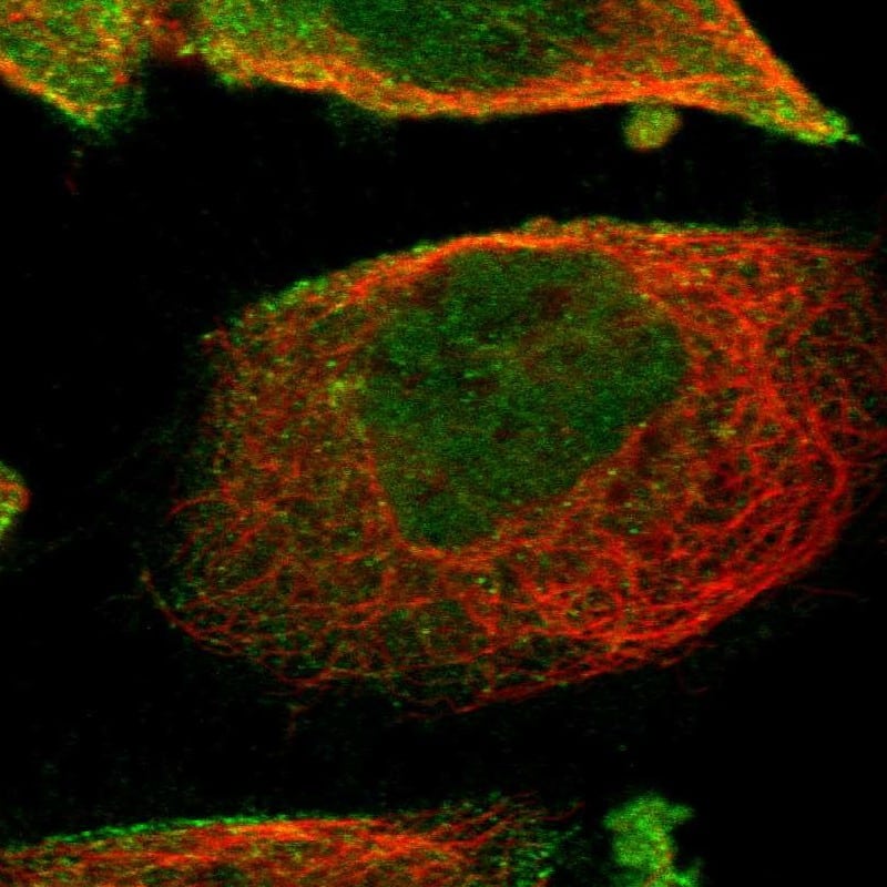 Staining of human cell line A-431 shows localization to nucleoplasm & plasma membrane.