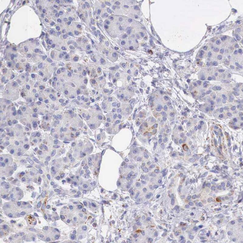 Staining of human pancreas shows weak positivity in exocrine glandular cells.