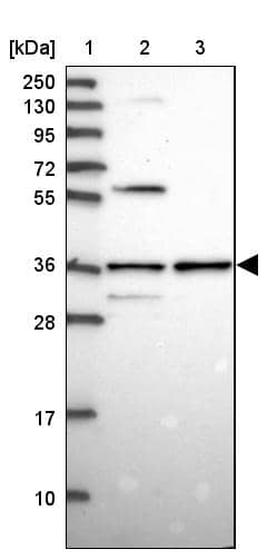 Lane 1: Marker [kDa] 250, 130, 95, 72, 55, 36, 28, 17, 10Lane 2: Human cell line RT-4Lane 3: Human cell line U-251MG sp