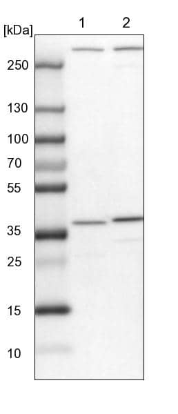 Lane 1: NIH-3T3 cell lysate (Mouse embryonic fibroblast cells)Lane 2: NBT-II cell lysate (Rat Wistar bladder tumour cells)