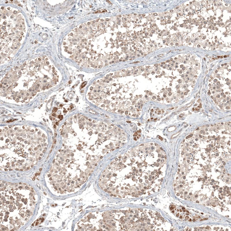 Immunohistochemistry-Paraffin CPNE7 Antibody - BSA Free