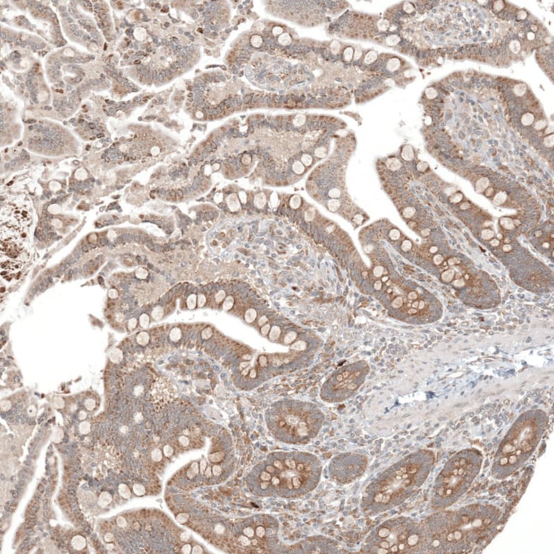 Immunohistochemistry-Paraffin CPNE7 Antibody - BSA Free