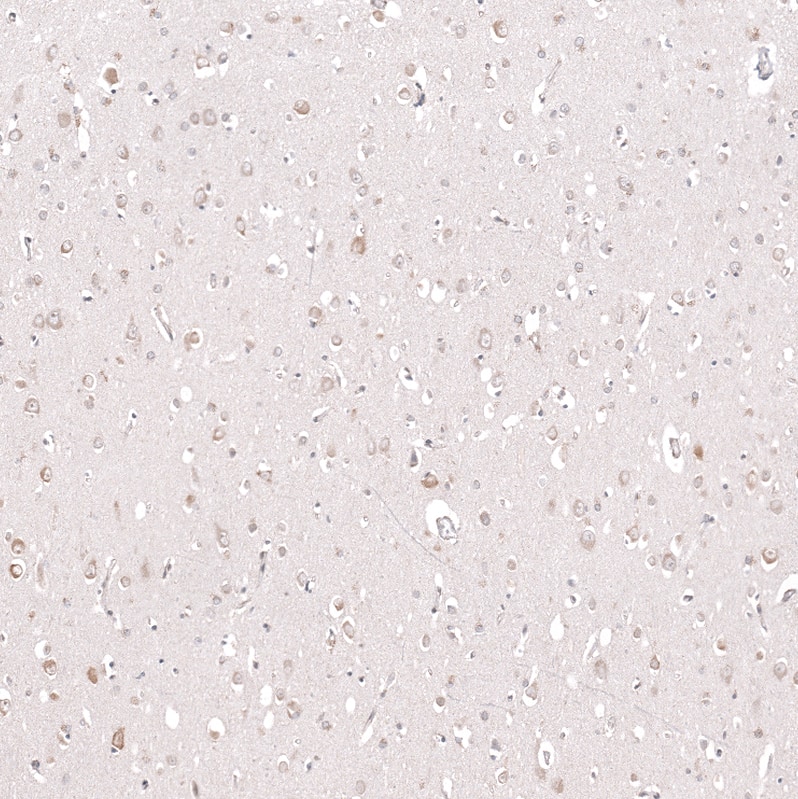 Staining of human cerebral cortex shows moderate cytoplasmic positivity in neurons.