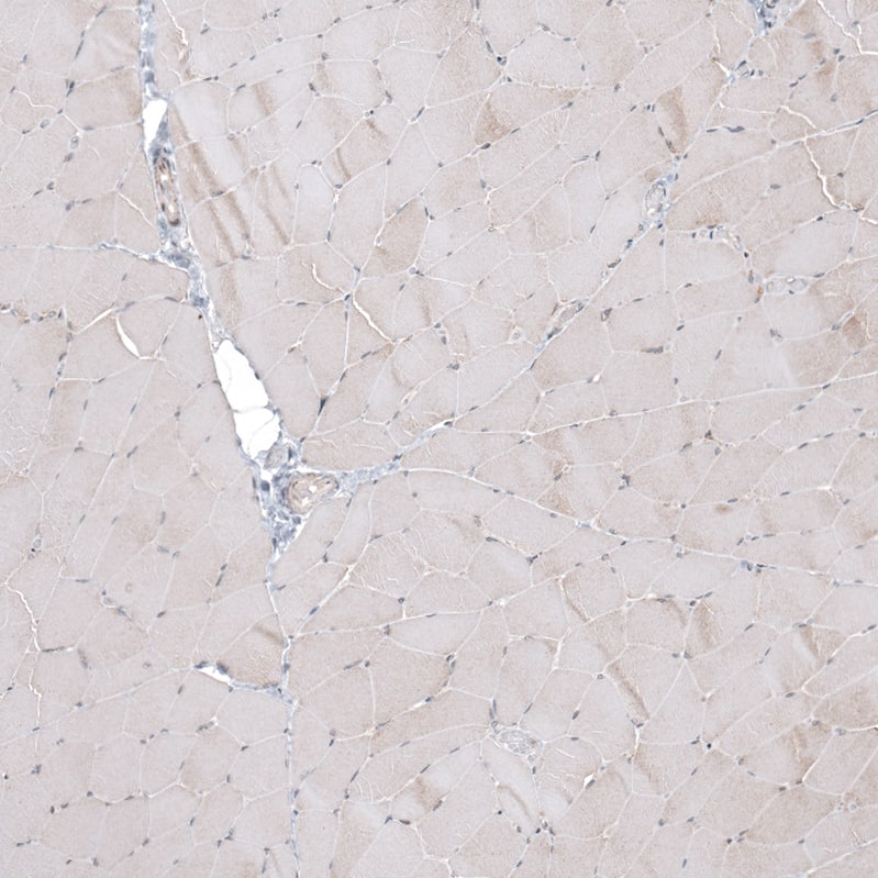 Immunohistochemistry-Paraffin CPNE7 Antibody - BSA Free