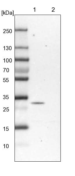 Lane 1: Mouse liver tissue lysateLane 2: Rat liver tissue lysate
