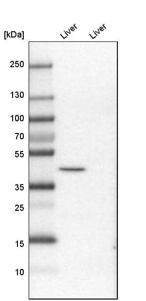 Analysis in mouse liver tissue and rat liver tissue.