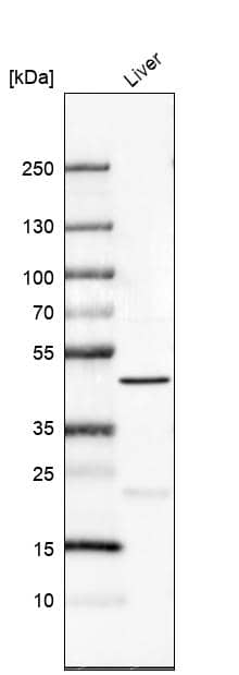 Analysis in human liver tissue.