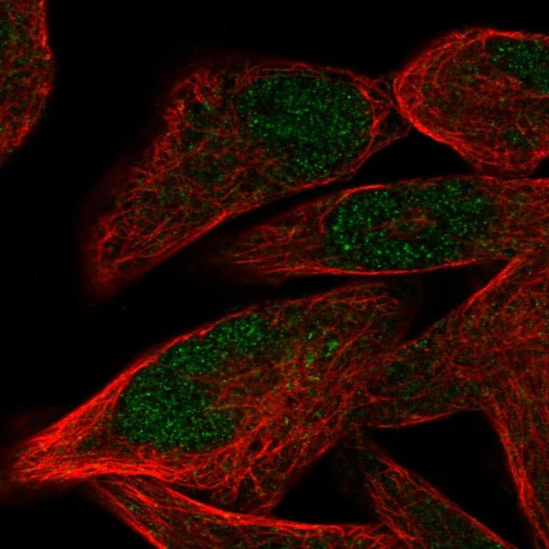 Staining of human cell line RH-30 shows localization to nucleus.