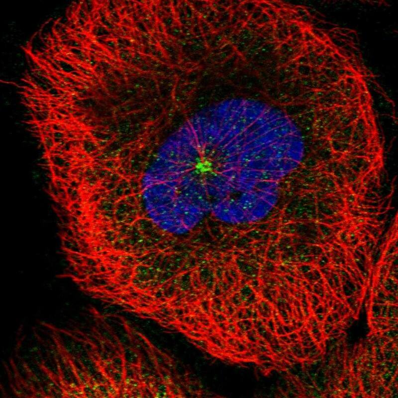 Staining of human cell line A-431 shows localization to cytosol & centrosome.
