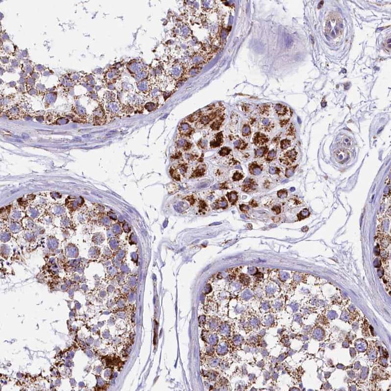 Staining of human Testis shows strong granular cytoplasmic positivity in Leydig cells.