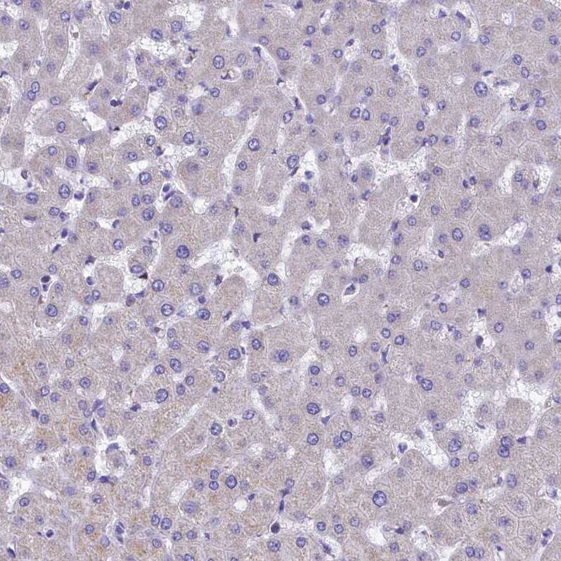 Staining of human Liver shows very weak granular cytoplasmic positivity in hepatocytes.