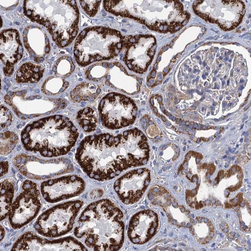 Staining of human kidney shows strong granular cytoplasmic positivity in cells in tubules..