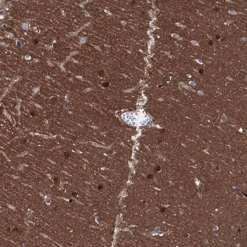 Immunohistochemistry-Paraffin CBLN3 Antibody - BSA Free