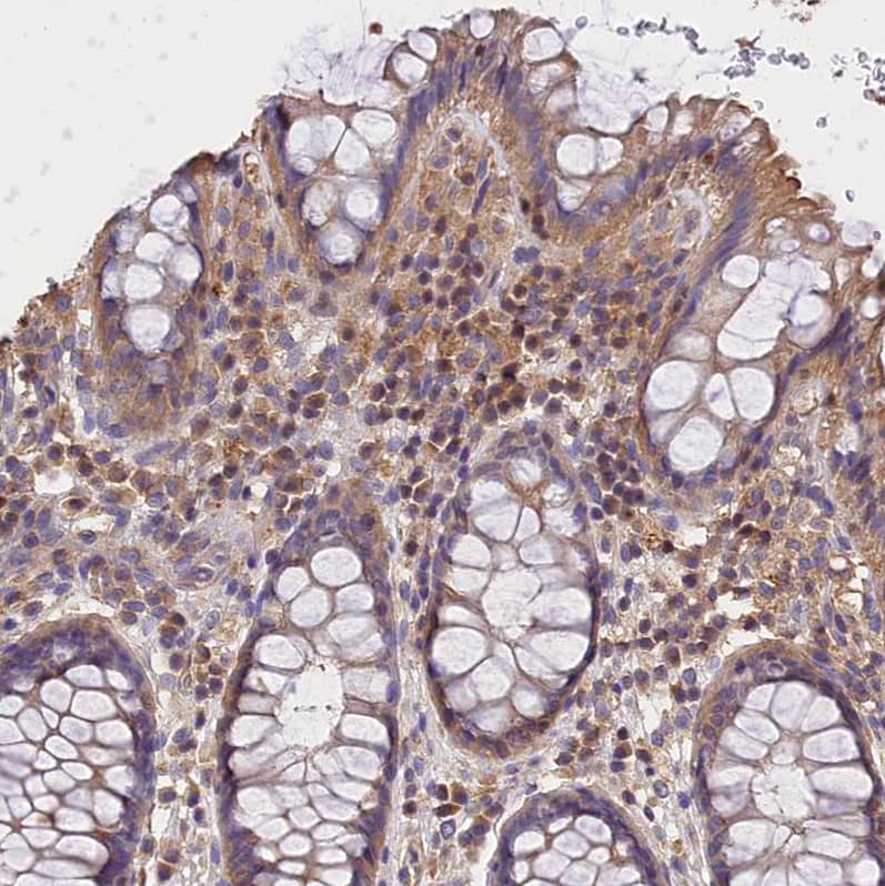 Staining of human rectum shows moderate cytoplasmic positivity in lymphoid cells.