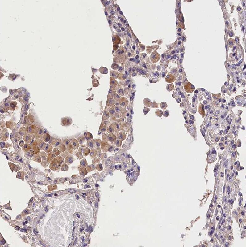 Staining of human lung shows moderate cytoplasmic positivity in macrophages.