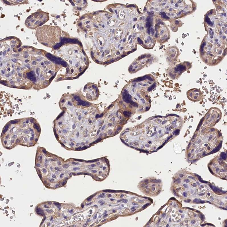 Staining of human placenta shows moderate cytoplasmic positivity in trophoblastic cells.