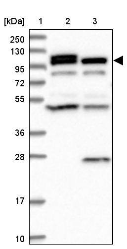 Lane 1: Marker [kDa] 250, 130, 95, 72, 55, 36, 28, 17, 10Lane 2: Human cell line RT-4Lane 3: Human cell line U-251MG sp