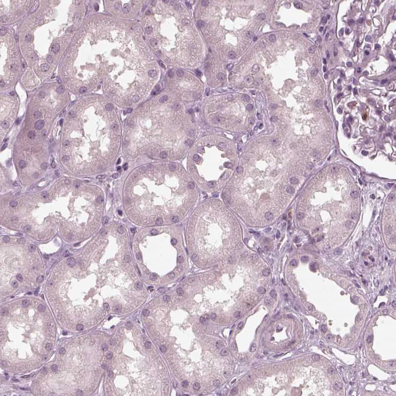 Staining of human kidney shows no positivity in cells in tubules as expected.
