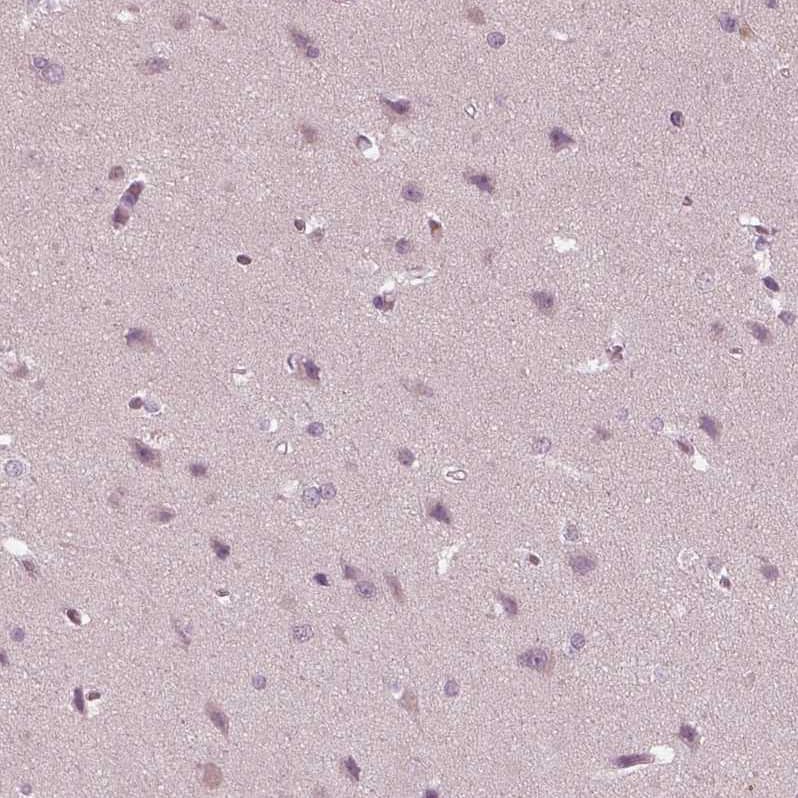 Staining of human cerebral cortex shows no positivity in neurons as expected.