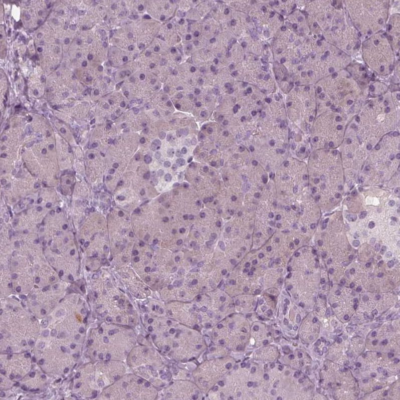Staining of human pancreas shows no positivity in exocrine glandular cells as expected.