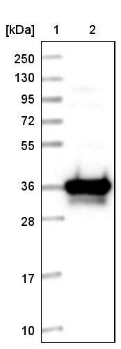 Lane 1: Marker [kDa] 250, 130, 95, 72, 55, 36, 28, 17, 10Lane 2: Human cell line RT-4