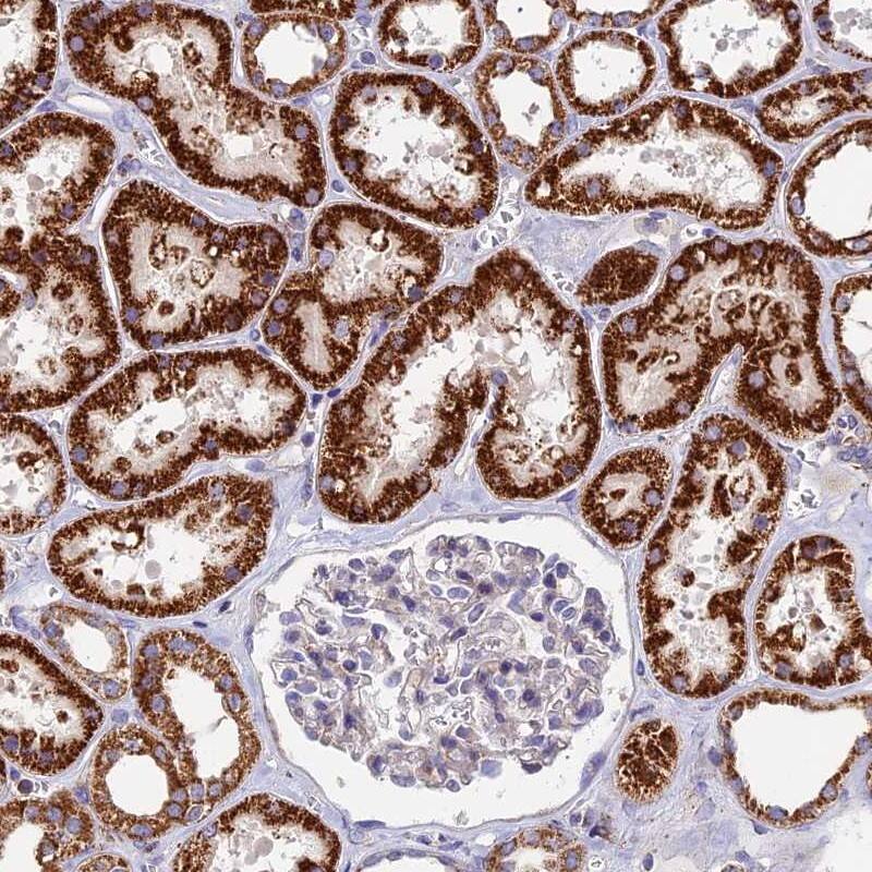 Immunohistochemistry-Paraffin ADAT1 Antibody - BSA Free