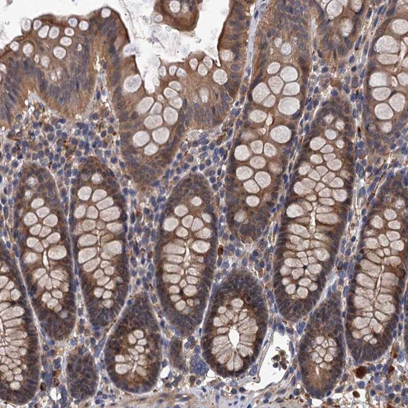 Immunohistochemistry-Paraffin LRRC2 Antibody - BSA Free