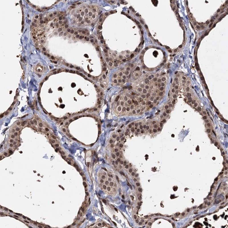 Immunohistochemistry-Paraffin PIGB Antibody - BSA Free