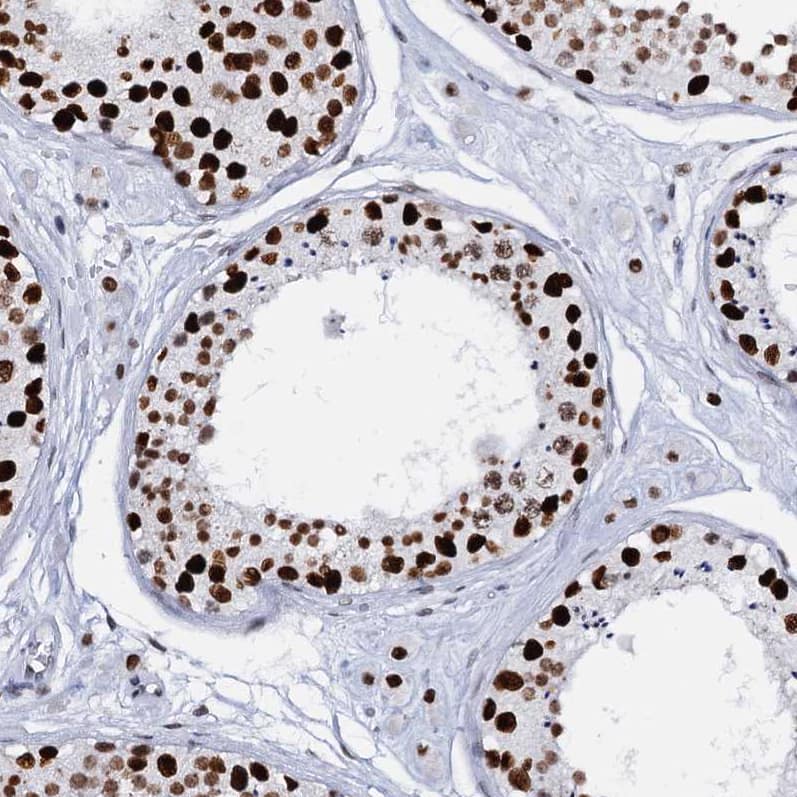 Staining of human testis shows strong nuclear positivity in cells in seminiferous ducts.