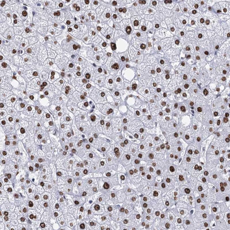 Staining of human liver shows strong nuclear positivity in hepatocytes.
