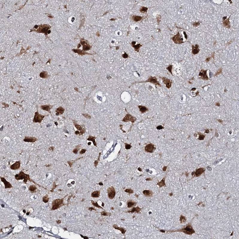 Staining of human cerebral cortex shows strong nuclear positivity in neurons.