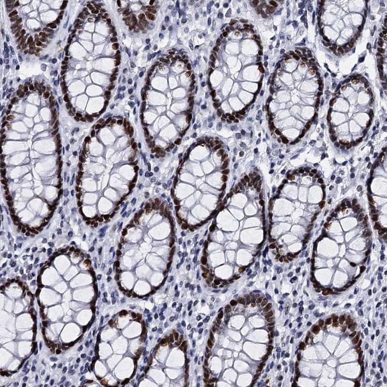 Staining of human colon shows strong nuclear positivity in glandular cells.