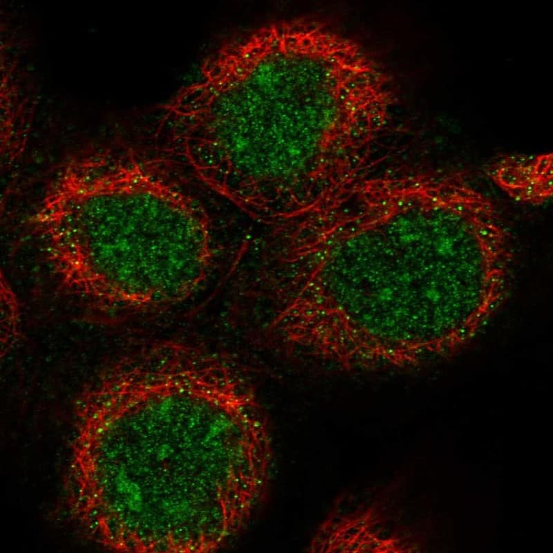 Staining of human cell line A-431 shows localization to nucleus, nucleoli & cytosol.