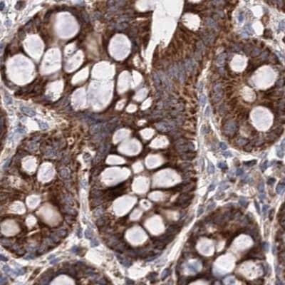Staining of human colon.