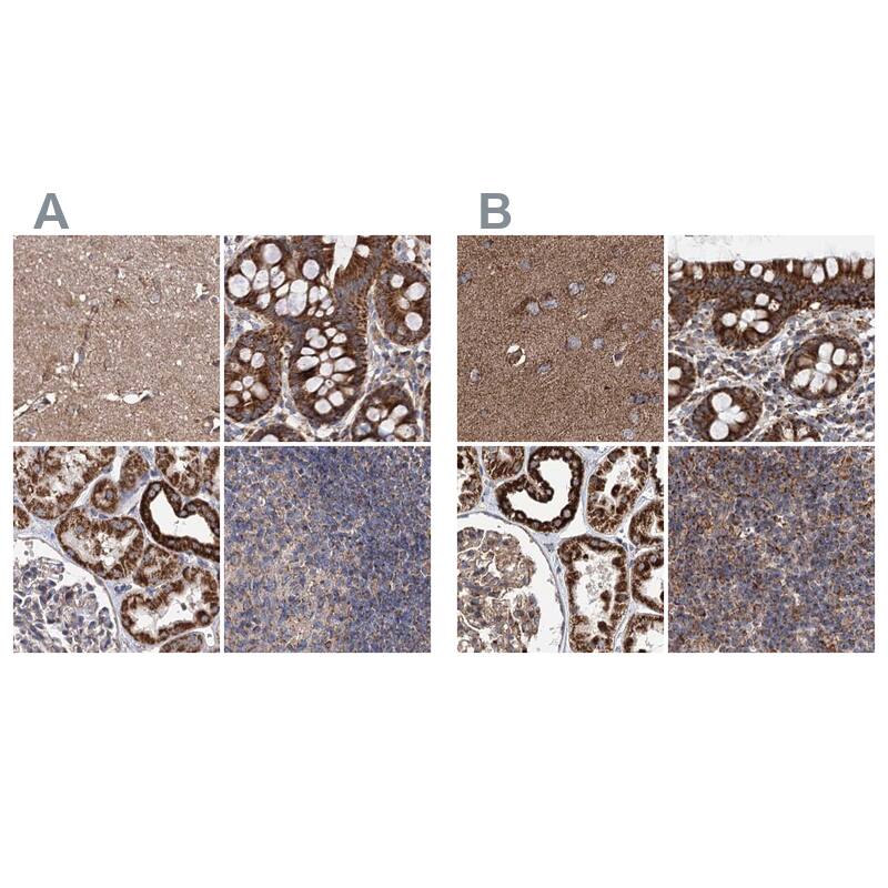 Staining of human cerebral cortex, colon, kidney and lymph node HPA039435 (A) shows similar protein distribution across tissues to independent antibody HPA039536 (B).