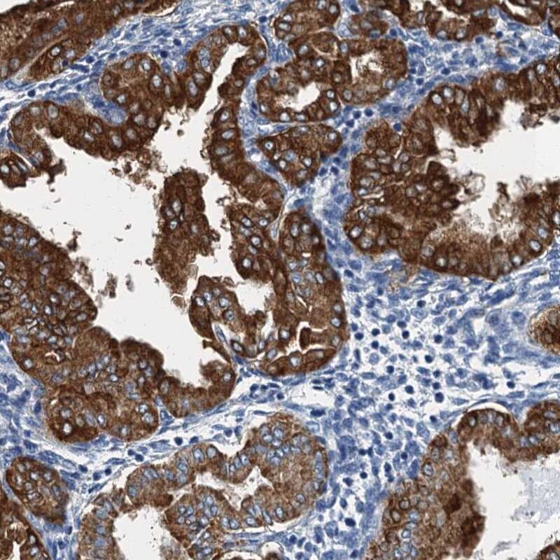 Immunohistochemistry-Paraffin GADL1 Antibody - BSA Free