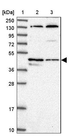 Lane 1: Marker [kDa] 250, 130, 95, 72, 55, 36, 28, 17, 10Lane 2: Human cell line RT-4Lane 3: Human cell line U-251MG sp