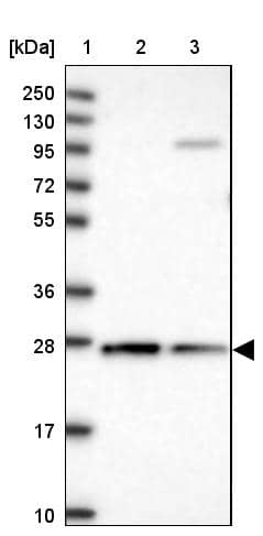 Lane 1: Marker [kDa] 250, 130, 95, 72, 55, 36, 28, 17, 10Lane 2: Human cell line RT-4Lane 3: Human cell line U-251MG sp