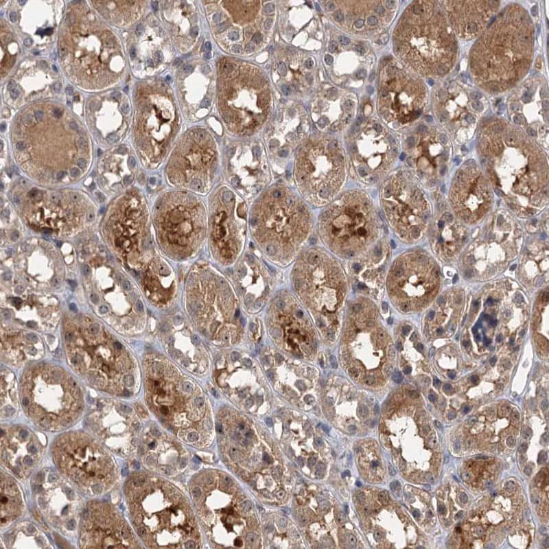 Immunohistochemistry-Paraffin SNX15 Antibody - BSA Free