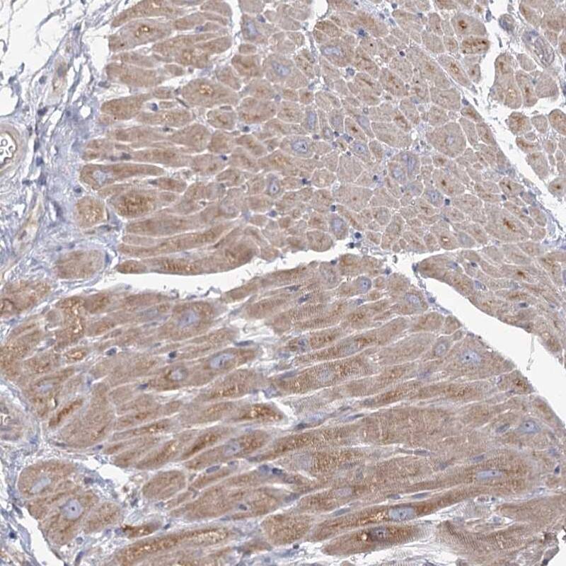 Staining of human heart muscle shows moderate cytoplasmic positivity in myocytes.