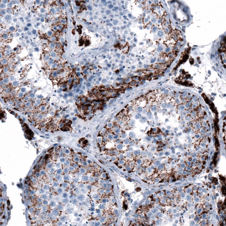 Immunohistochemistry-Paraffin ME3 Antibody - BSA Free